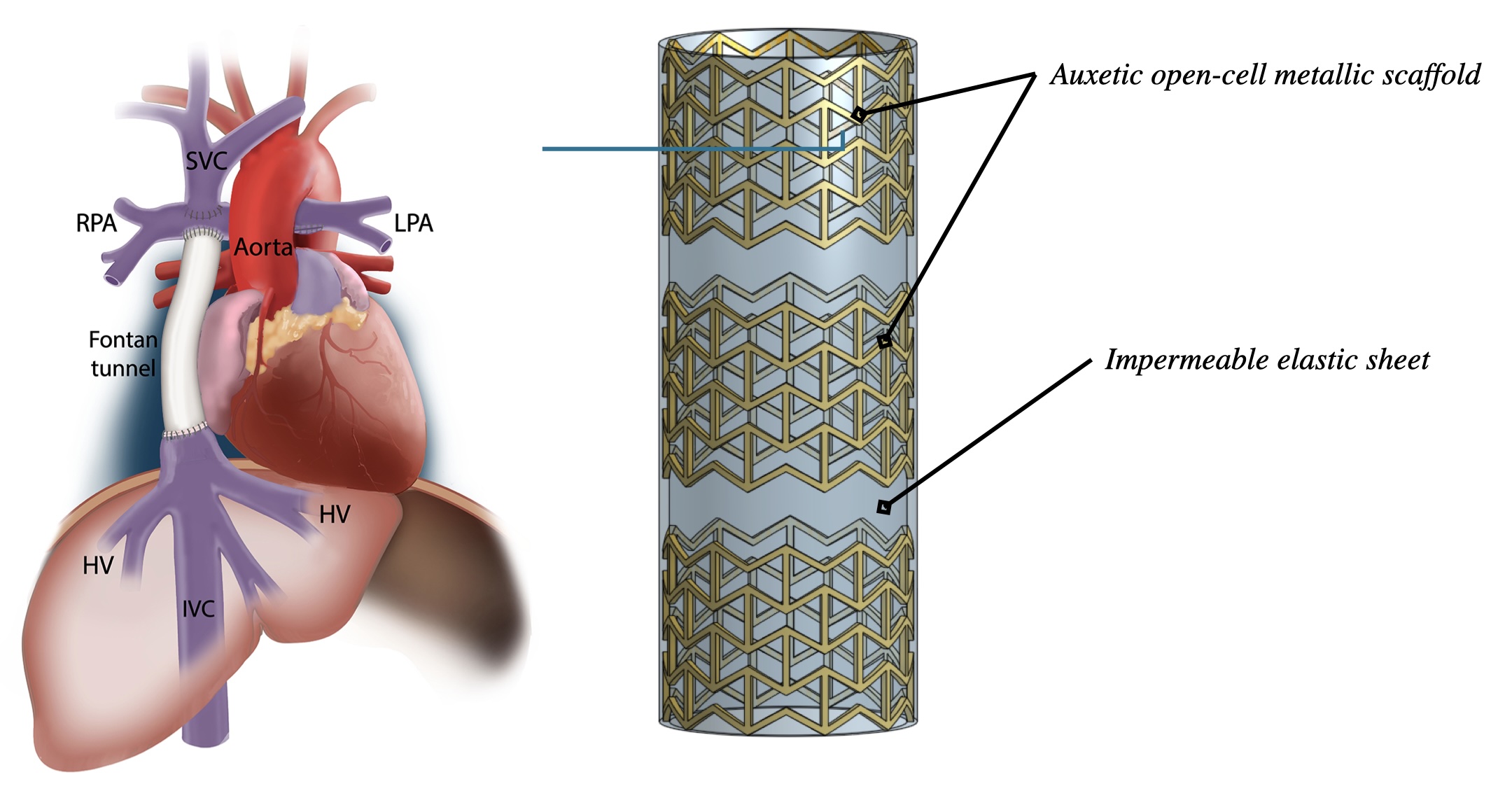 Flow in Fontan circulation.