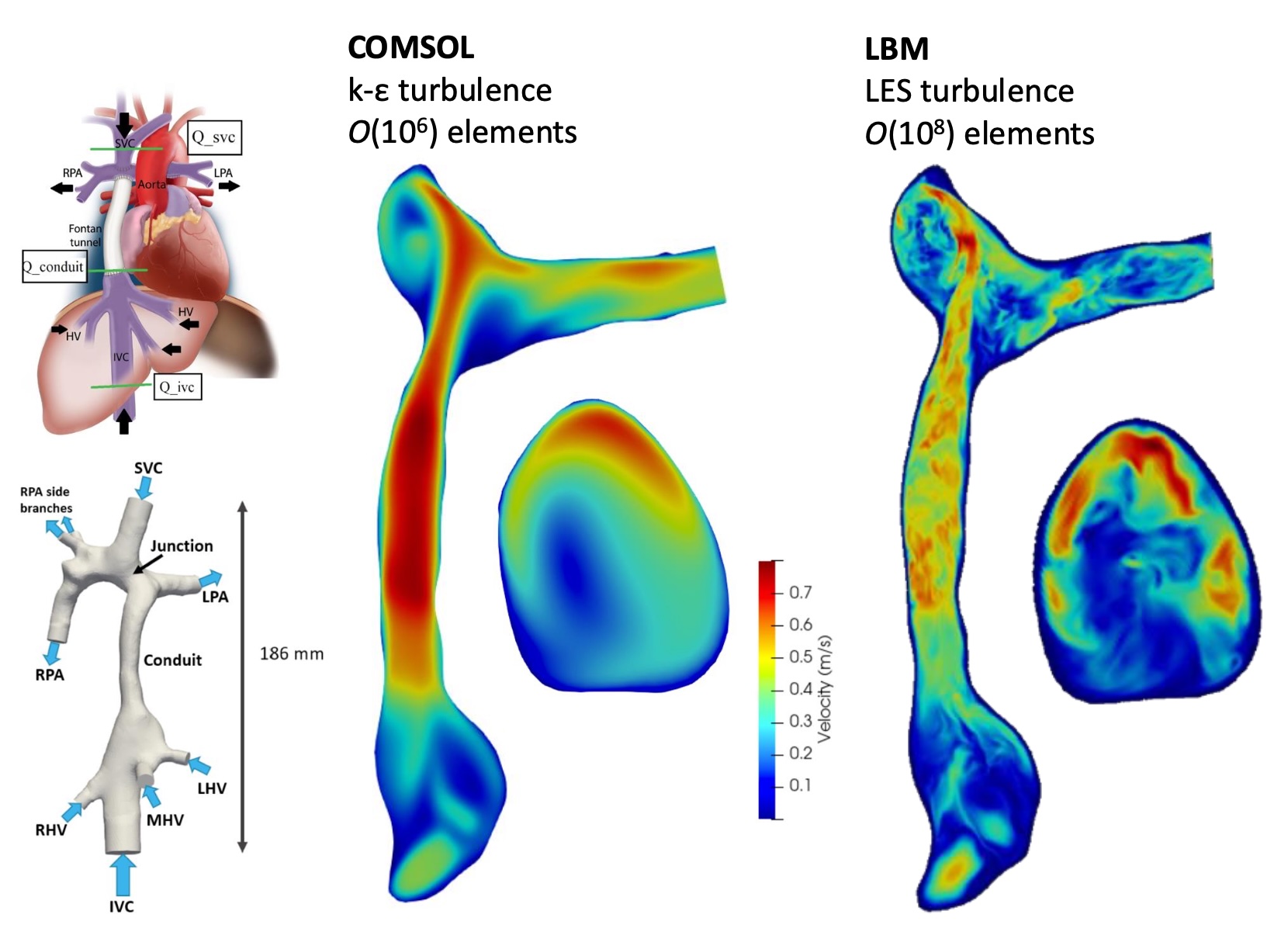 Flow in Fontan circulation.